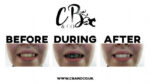 Cougar Beauty Extreme Whitening Duo Set with Activated Charcoal - Image 3